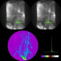 Estudio de la mejora de calidad de imagen en radiodiagnóstico